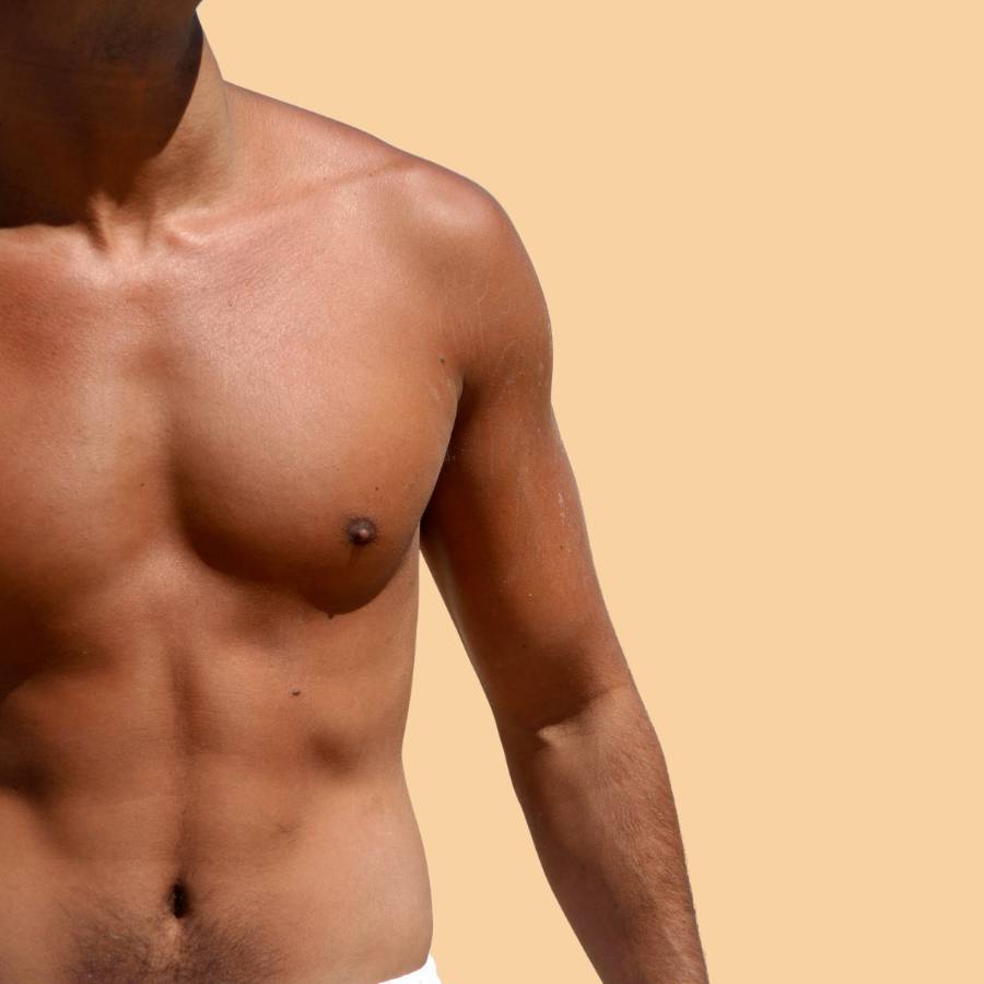 ABDOMINOPLASTIA