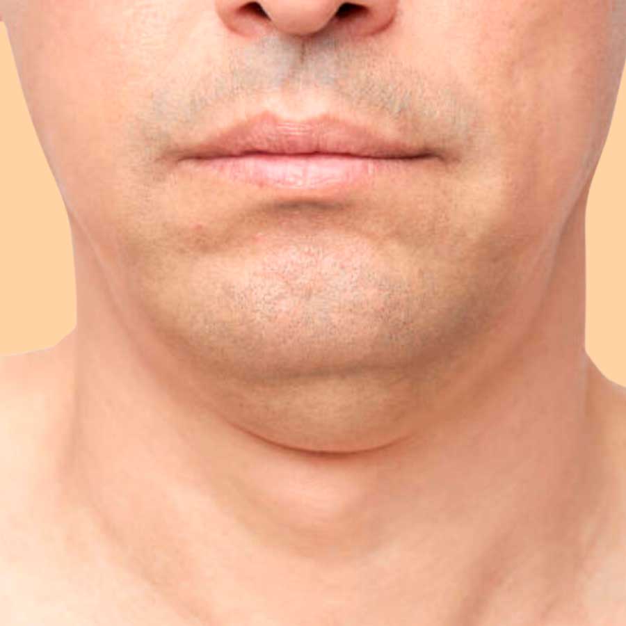 ESTIRAMIENTO DE CUELLO Y PAPADA 