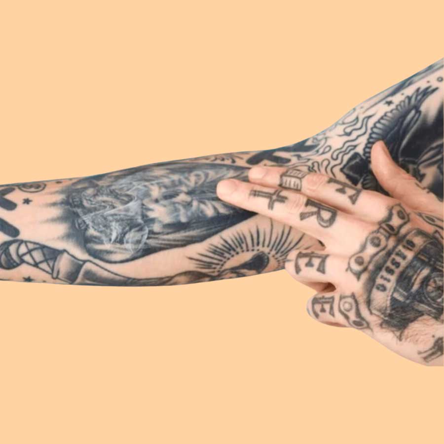 TATTOO REMOVAL